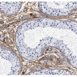 Tetratricopeptide Repeat Protein 32 (TTC32) Antibody