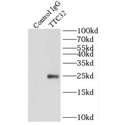 Tetratricopeptide Repeat Protein 32 (TTC32) Antibody