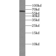 WB analysis of mouse testis tissue, using TTC39B antibody (1/800 dilution).