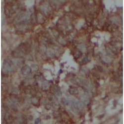 Dual Specificity Protein Kinase TTK (TTK) Antibody