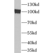 WB analysis of Jurkat cells, using TUBGCP3 antibody (1/1000 dilution).