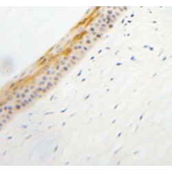 Tubby-Related Protein 1 (TULP1) Antibody