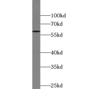 WB analysis of SH-SY5Y cells, using TULP3 antibody (1/800 dilution).