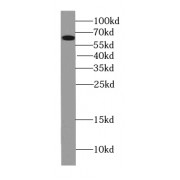 WB analysis of HeLa cells, using PEO1 antibody (1/300 dilution).