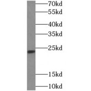 WB analysis of PC-3 cells, using TWIST1 antibody (1/300 dilution).