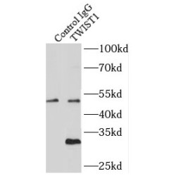 TWIST1-specific Antibody