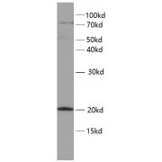 WB analysis of NIH/3T3 cells, using TWIST2 antibody (1/1000 dilution).