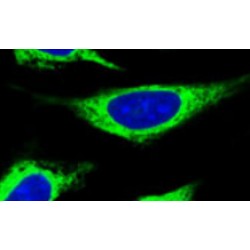 Thioredoxin Domain Containing 16 (TXNDC16) Antibody