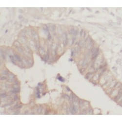 Thioredoxin Domain-Containing Protein 5 (TXNDC5) Antibody