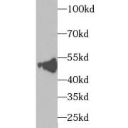 WB analysis of HepG2 cells, using TXNDC5 antibody (1/1000 dilution).