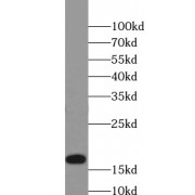 WB analysis of HEK-293 cells, using TXNL4B antibody (1/500 dilution).