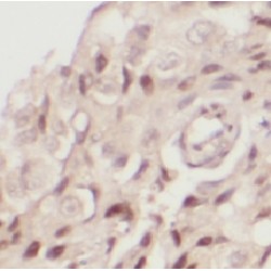 Thioredoxin Reductase 1, Cytoplasmic (TXNRD1) Antibody