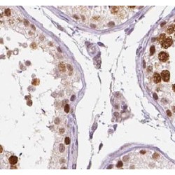 Thioredoxin Reductase 3 (TXNRD3) Antibody