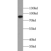 WB analysis of human testis tissue, using TXNRD3 antibody (1/300 dilution).