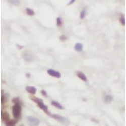 Splicing Factor U2AF 35 KDa Subunit (U2AF1) Antibody