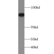 WB analysis of human brain tissue, using UBA2 antibody (1/500 dilution).