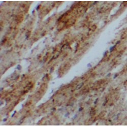 Ubiquitin-Associated Domain-Containing Protein 1 (UBAC1) Antibody