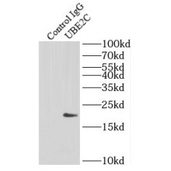 Ubiquitin Conjugating Enzyme E2C (UBE2C) Antibody