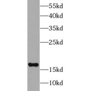 WB analysis of HeLa cells, using UBE2C antibody (1/1000 dilution).