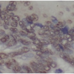 Ubiquitin Conjugating Enzyme E2C (UBE2C) Antibody