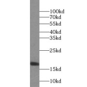 WB analysis of mouse brain tissue, using UBE2D4 antibody (1/500 dilution).