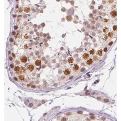 Ubiquitin-Conjugating Enzyme E2 E2 (UBE2E2) Antibody