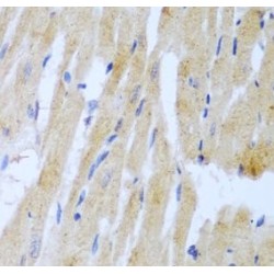 Ubiquitin-Conjugating Enzyme E2 L3 (UBE2L3) Antibody