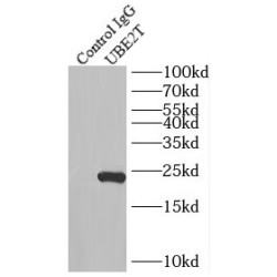 UBE2T (UBE2T/HSPC150) Antibody