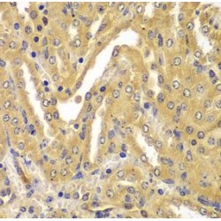 Ubiquitin Conjugating Enzyme E2 Z (UBE2Z) Antibody