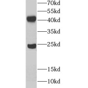 WB analysis of human testis tissue, using UBE2Z antibody (1/1000 dilution).