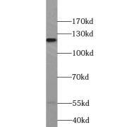 WB analysis of HEK-293 cells, using UBE4A antibody (1/500 dilution).