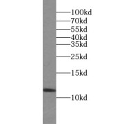 WB analysis of human brain tissue, using UBL3 antibody (1/1500 dilution).