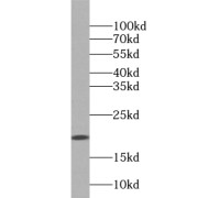 WB analysis of HeLa cells, using UBL4A antibody (1/400 dilution).