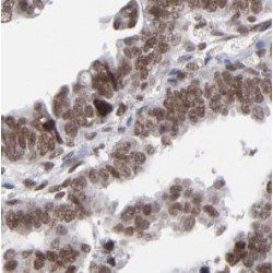 Ubiquitin-Like Domain-Containing CTD Phosphatase 1 (UBLCP1) Antibody