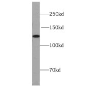 WB analysis of MCF7 cells, using UBN1-Specific antibody (1/300 dilution).