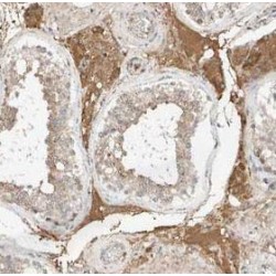 Ubiquilin-2 (UBQLN2) Antibody