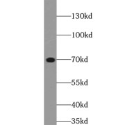 WB analysis of rat brain tissue, using UBQLN2 antibody (1/800 dilution).