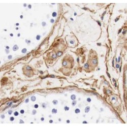 Ubiquilin-3 (UBQLN3) Antibody