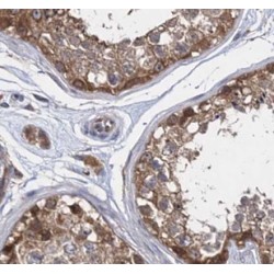 Ubiquilin-Like Protein (UBQLNL) Antibody