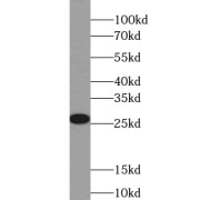WB analysis of human liver tissue, using UBTD2 antibody (1/400 dilution).