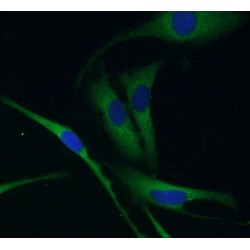 Ubiquitin Carboxyl Terminal Hydrolase L1 (UCHL1) Antibody