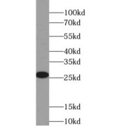 WB analysis of fetal human brain tissue, using UCHL1 antibody (1/20000 dilution).