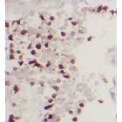 Ubiquitin Carboxyl Terminal Hydrolase L5 (UCHL5) Antibody