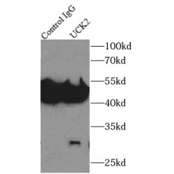 Uridine-Cytidine Kinase 2 (UCK2) Antibody