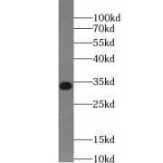 WB analysis of Jurkat cells, using UCK2 antibody (1/500 dilution).
