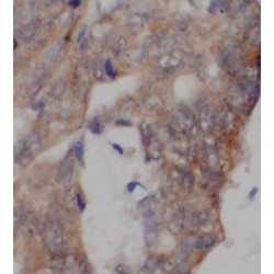 Mitochondrial Uncoupling Protein 2 (UCP2) Antibody