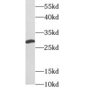 WB analysis of mouse skeletal muscle tissue, using UCP2 antibody (1/1000 dilution).