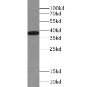 WB analysis of fetal human brain tissue, using SLC25A14 antibody (1/300 dilution).