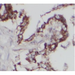 UDP-Glucose Ceramide Glucosyltransferase (UGCG) Antibody