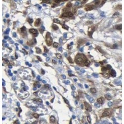 UTP Glucose-1-Phosphate Uridylyltransferase (UGP2) Antibody